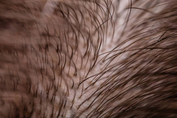 Kickstart Your Hair at the Root