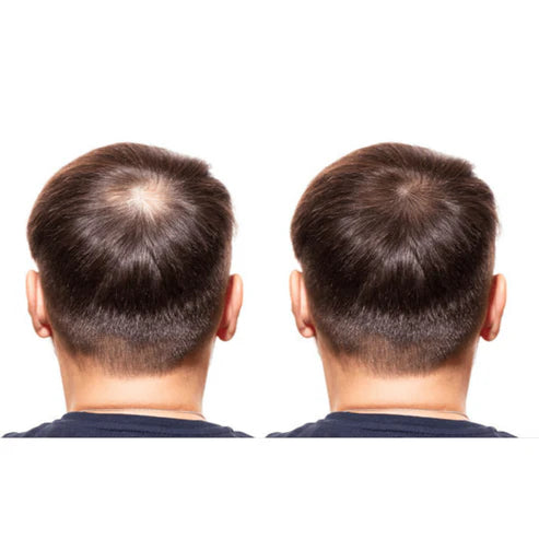 #1 Hair Building Fibers