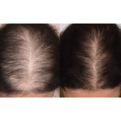#1 Hair Building Fibers