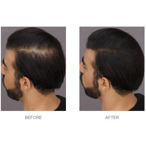 #1 Hair Building Fibers