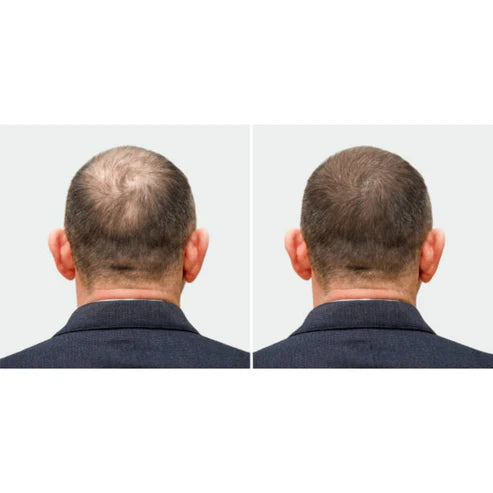 #1 Hair Building Fibers