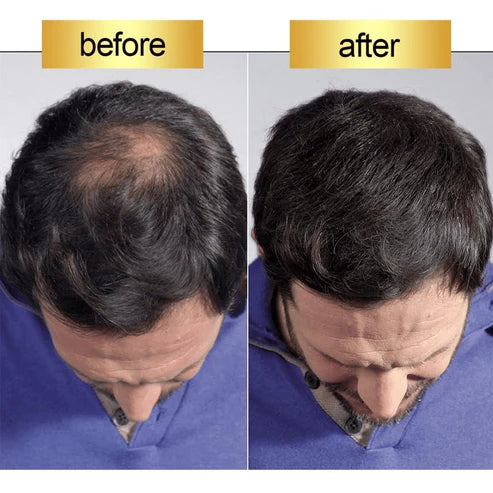 #1 Hair Building Fibers