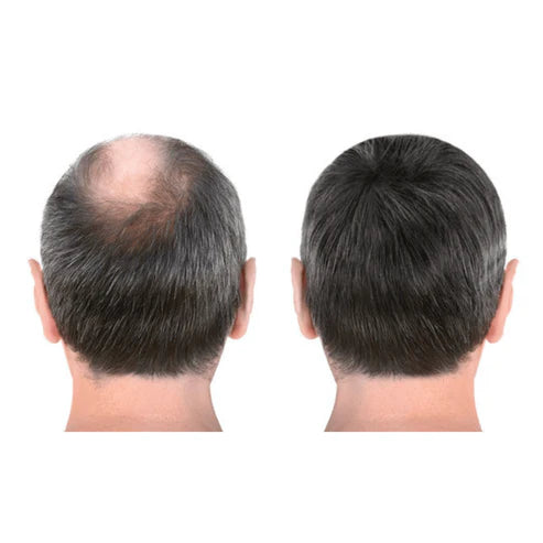#1 Hair Building Fibers