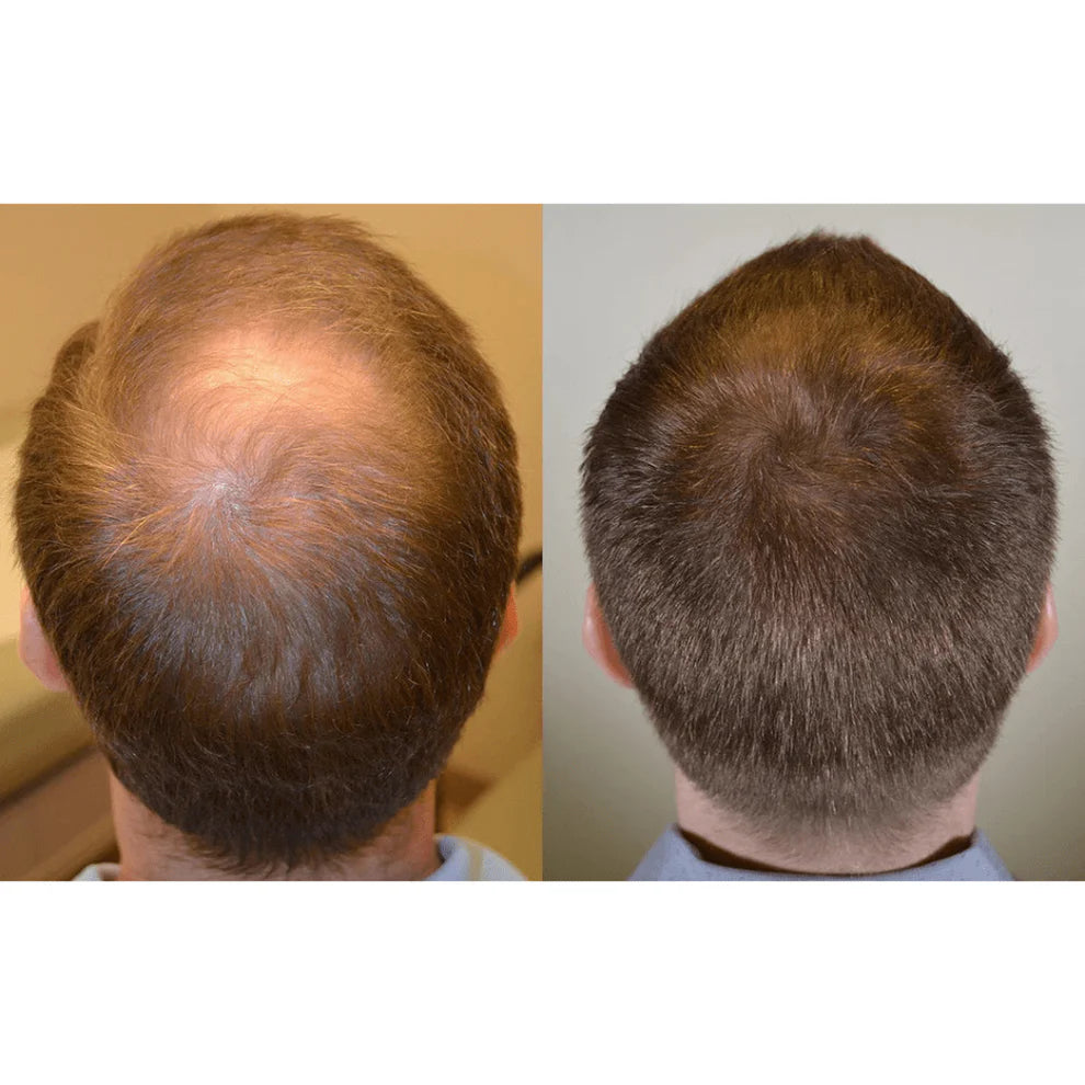 #1 Magic Hair Concealer