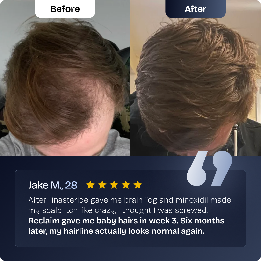 Hairline Recovery Serum